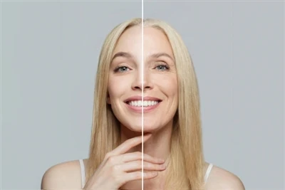 Is NMN superior to collagen? Is NMN superior to collagen?